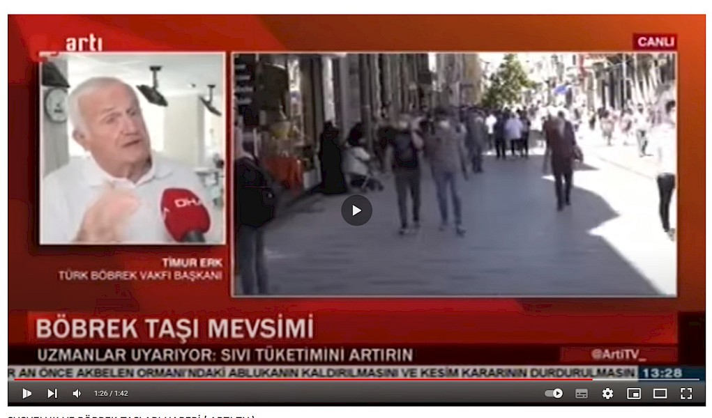 Böbrek Taşı Mevsimi Artı Haber