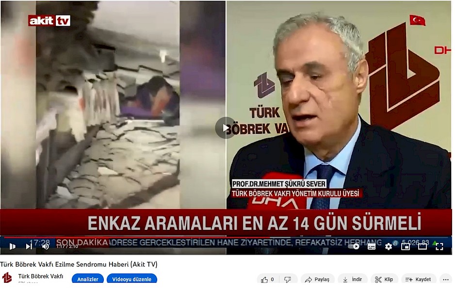 TBV Ezilme Sendromu Haberi (Akit TV)