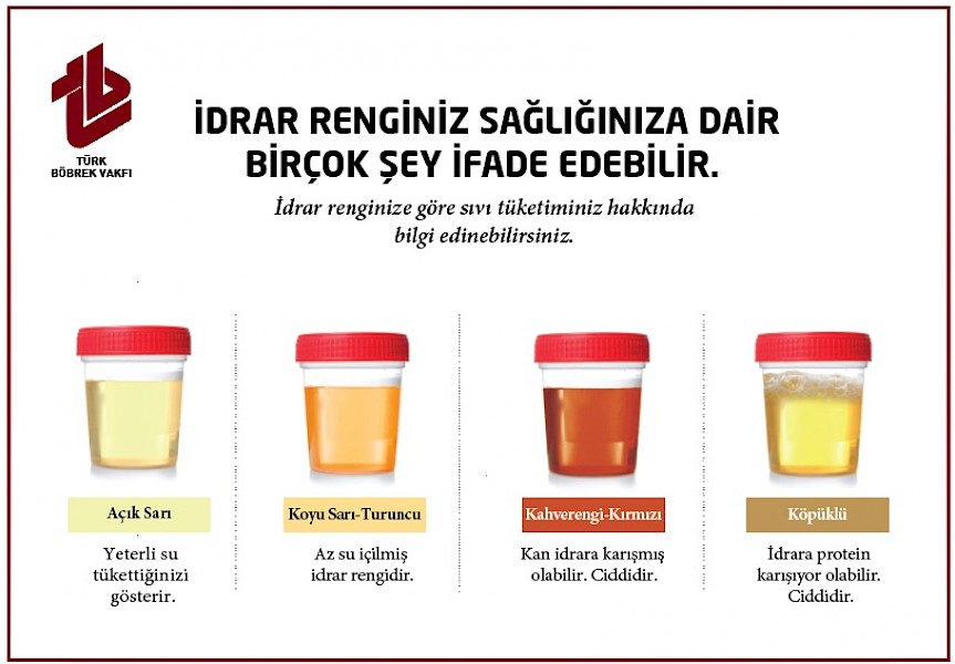 İdrar Afişi