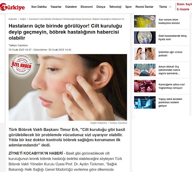 Cilt Kuruluğu Böbrek Hastalığının Habercisi Olabilir