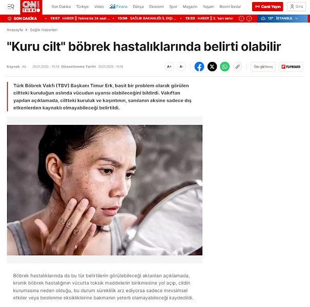 Kuru Cilt Böbrek Hastalıklarında Haberci Olabilir