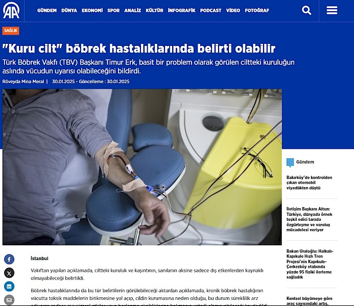 Kuru Cilt Böbrek Hastalıklarında Belirleyici Olabilir