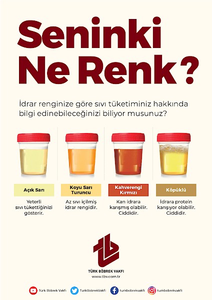 Seninki Ne Renk?